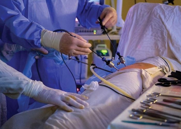 The Advancement of Minimally Invasive Device Design