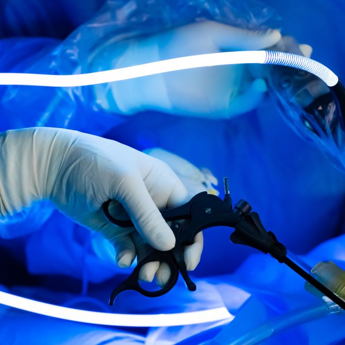 The surgeon's hand operates with a laparoscopic instrument.